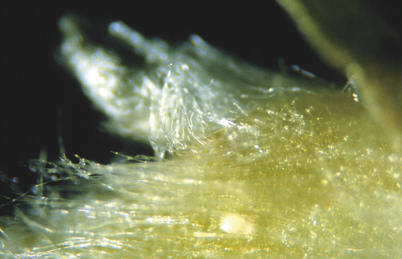 Spider Mites